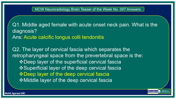 PublishedXPrime's tweet photo. #MCWNeuroradBTW 007 Ans: Acute Calcific Longus Colli Tendonitis

Check out DCF layers on #TeachingMoment

Short vid link with ddx: https://t.co/E6FbC086XM

Thanks @Jaswal_Shama @RGovindiah @bdoop3210 @elmitte for participating
 
#FOAMed #FOAMrad #radres #MedEd #RadEd #HNRad https://t.co/Zb9ybt0ghn
