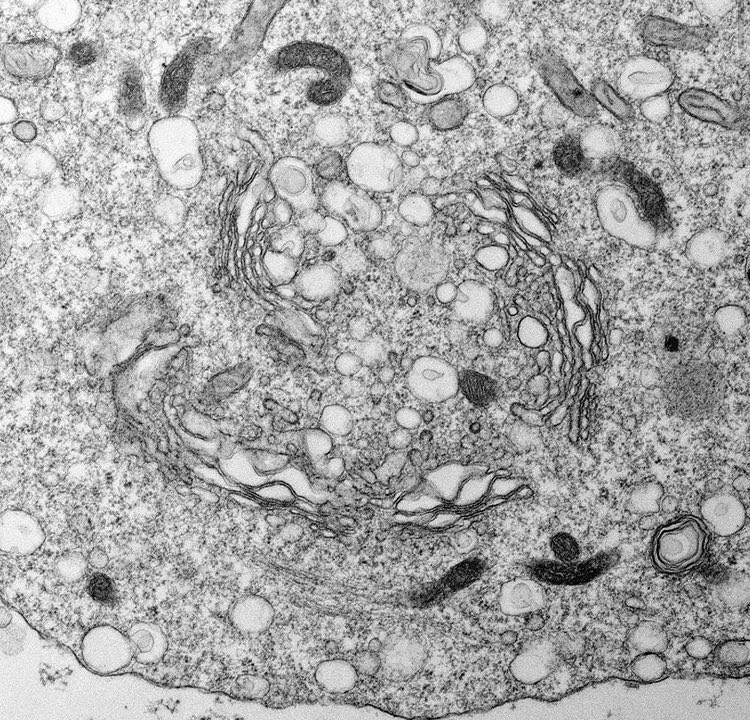 Cellfie3's tweet photo. And this is what I call a Golgi get together 😁👌🏻 #cell #golgi #organelle #cellfie #nerdgram #gettogether #socialdistancingmemes #socialdistancing #covid #patient #disease #research #electronmicroscopy #womeninstem #basicwitch https://t.co/6CD2nelfTU
