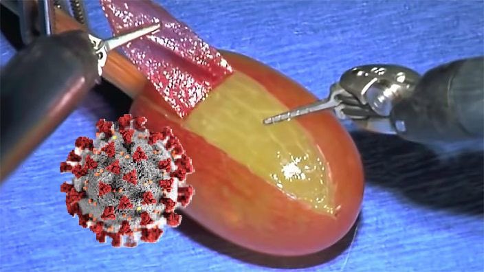 BREAKING: the grape they did surgery on has officially tested positive for COVID-19