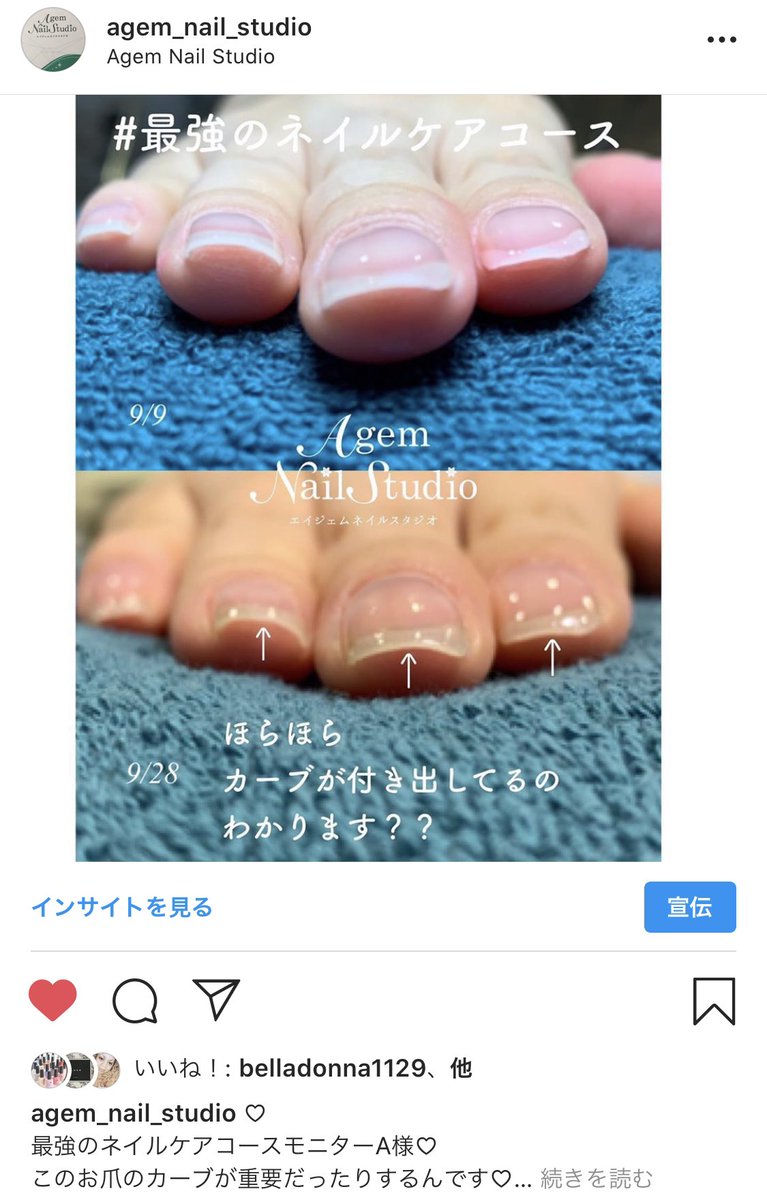 最強のネイルケア Twitter Search Twitter