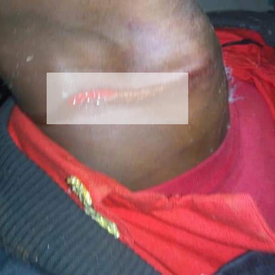 IAmSegawa's tweet photo. ***M7 STOP KILLING UGANDANS ***
One of our comrades survived death as he went missing yesterday afternoon &we got a report that he was arrested.He returned back when his neck blood vessel was cut, front tooth removed &couldn't even talk. This regime will fall!๐ญ #Quick_Recovery https://t.co/wvjEtwzozi