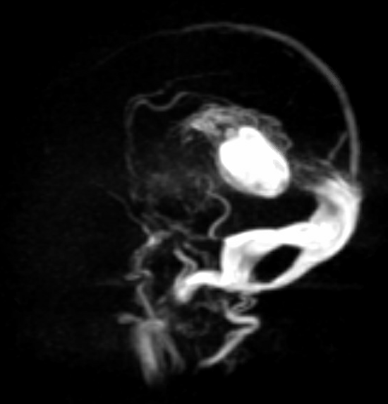 UofL Child Neurology tweet media