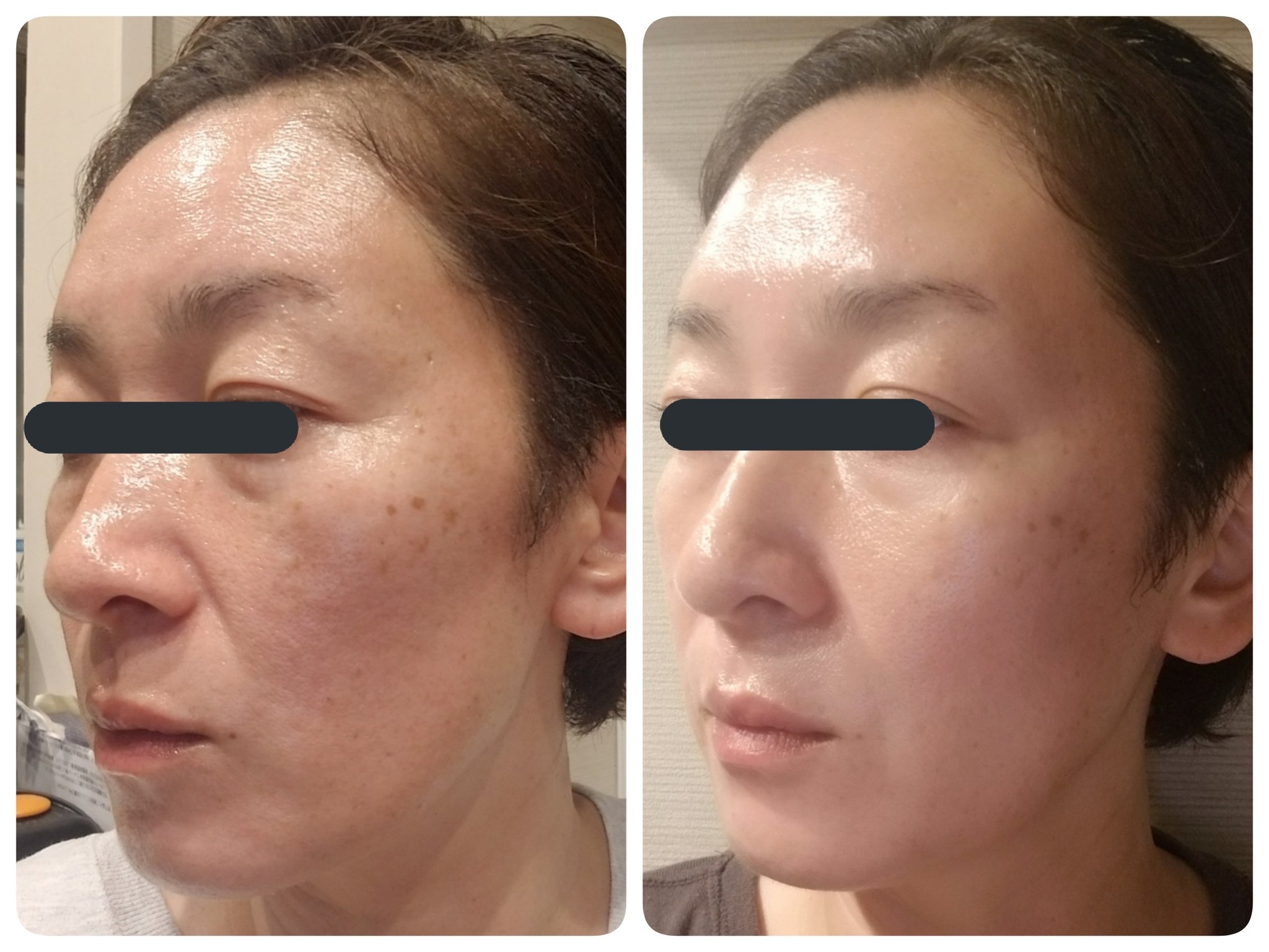 いいたしま┪ エニシー パック 7回分 raFYx-m97202196807 グロー なので