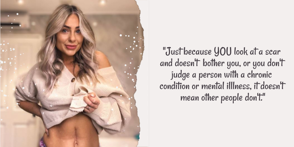 Crohn's and Colitis Awareness tweet media