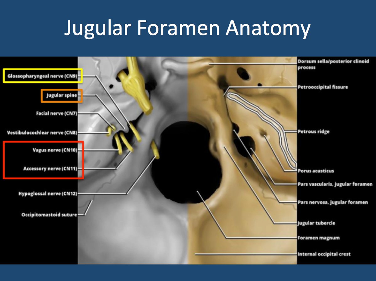 "Krause's nodes" are in the jugular foramen, and their enlargement in cancer can cause injury to cranial nerves IX, X, and XI. I think they’re named for German anatomist Wilhelm Krause (1833-1910), but could also be Karl Friedrich Theodor Krause (1797-1868) - couldn't confirm./17