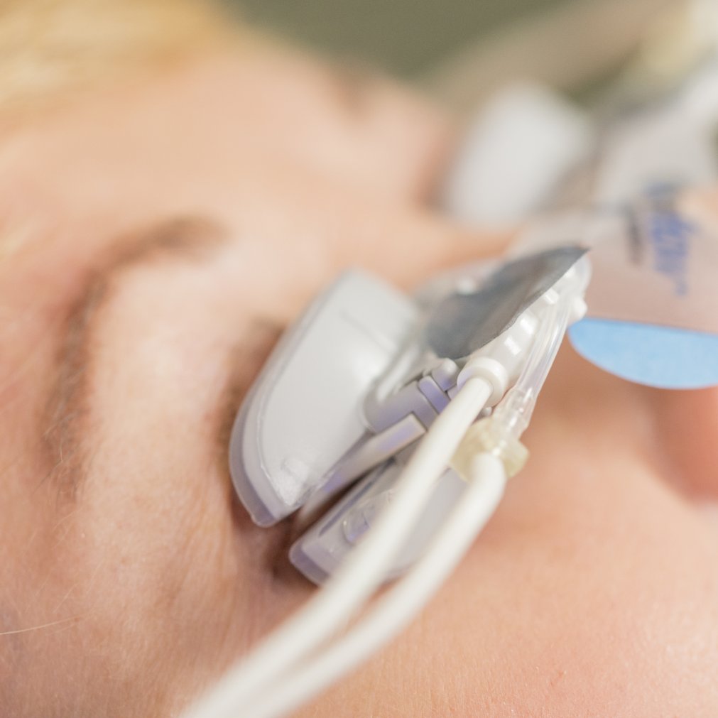 OptometrySD's tweet image. Dry eyes got you down?  Our new Lipiflow treatment can help!  ⁠
This device gives your eyelids a gentle warm massage which improves your oil secretion, allowing you to create normal tears.  You&apos;ll feel like you again. #lipiflow #dryeye

Learn More:
invisioncare.com/dry-eye-manage… ⁠

⁠