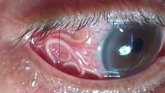 ArkansasWildman's tweet photo. I read he had a mild eye infection! https://t.co/DsckHObrAo