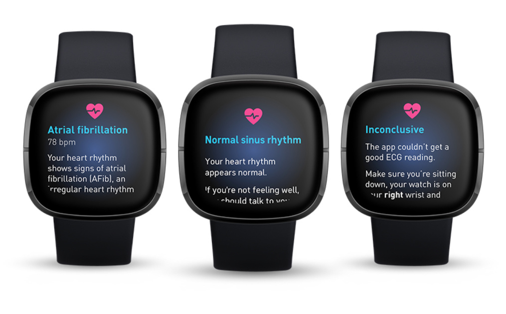 Fitbit's Sense smartwatch begins receiving ECG app update