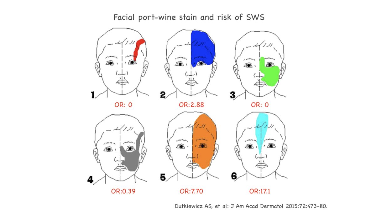 SUNPORT NAKAGAWA サンポートナカガワ＋BLUE SYNDROME Sturge-Weber syndrome and port-wine stain (PWS) are caused by