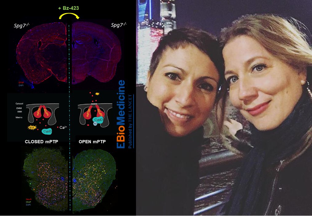 Tigem Telethon (@tigem_telethon) on Twitter photo Congratulations to <a href="/IreneSambri/">IreneSambri</a> and <a href="/MilliMassa/">Milli Massa</a> from Casari’s lab for their recent publication (and the #cover!) on @EBioMedicine. They showed that impaired #flickering of a mitochondrial pore causes spastic paraplegia type 7 #SPG7
Read more here! sciencedirect.com/science/articl… Congratulations to <a href="/IreneSambri/">IreneSambri</a> and <a href="/MilliMassa/">Milli Massa</a> from Casari’s lab for their recent publication (and the #cover!) on @EBioMedicine. They showed that impaired #flickering of a mitochondrial pore causes spastic paraplegia type 7 #SPG7
Read more here! sciencedirect.com/science/articl…