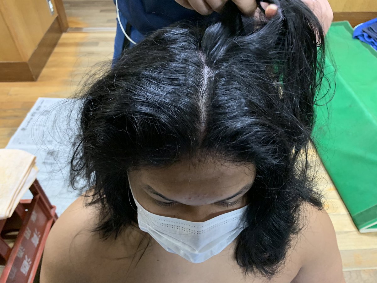 八角部屋 力士の象徴の髷は 力士の髪の量によって形が違います 序二段 中田は髪の量がかなり多く髷が太すぎてしまいますので 本日中剃りをしました 剃り取る分をまとめ 元結で束ねハサミで切ります この後バリカンで整え坊主頭のようになりました 八角部屋 力士の象徴の髷は 力士の髪の量によって形が違います 序二段 中田は髪の量がかなり多く髷が太すぎてしまいますので 本日中剃りをしました 剃り取る分をまとめ 元結で束ねハサミで切ります この後バリカンで整え坊主頭のようになりました