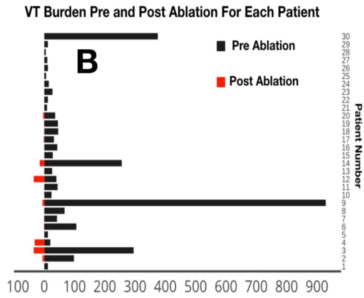 A huge honour to be to present the results of our functional substrate mapping technique using #HDGrid for VT Ablation <a href="/VTSymposium/">VT Symposium</a> the best meeting in the field. Thanks <a href="/AbbottCardio/">Abbott Cardiovascular</a> #EPeeps. I hope you can all tune in.