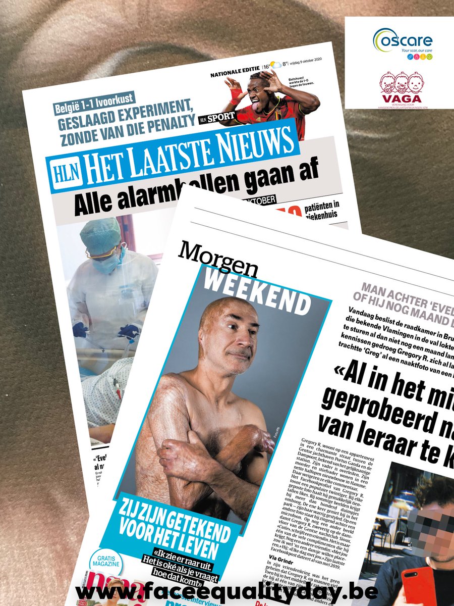vzwOscare's tweet photo. Morgen in de weekendkrant van https://t.co/UJhkMIfM6s: Naar aanleiding van “Dit is geen kunst, maar hedendaagse realiteit!” Doen Jan, Ragna, Frèderic en Evi hun verhaal. Zeker de moeite om te lezen. Stop met staren en teken... https://t.co/AdZzA7EWTT. #faceequalityday https://t.co/vKsv9K9nON
