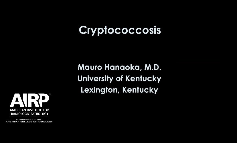 Mauro Hanaoka, MD, DABR, CIIP tweet media