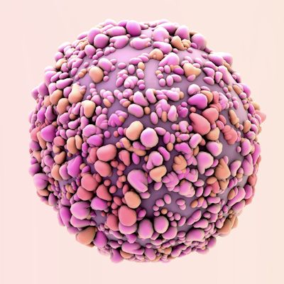 AuntMinnie's tweet photo. Women with high-risk breast tumors had more than double the chance of distant cancer spread if their cancer was interval-detected rather than found on screening #mammography, according to a new study. #EBCC12 https://t.co/uPVJt8xiYD https://t.co/EkLLfGefjg