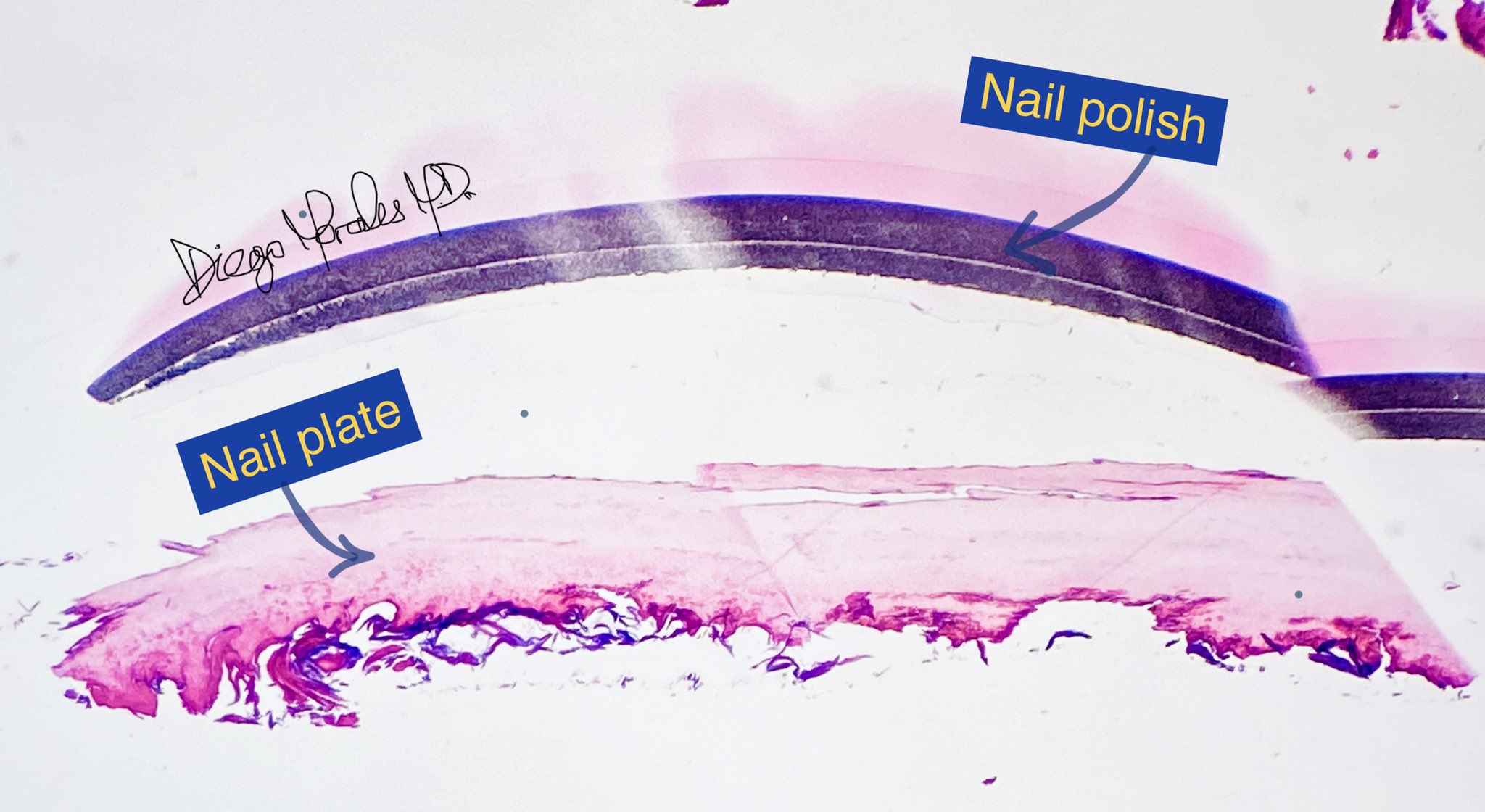 JFB | Free Full-Text | Nail Properties and Bone Health: A Review