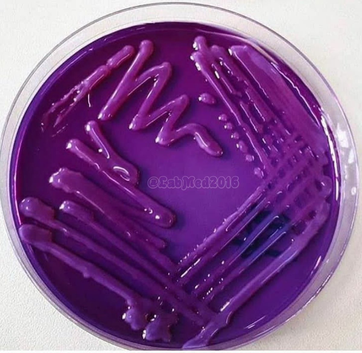 LabMed2016's tweet image. Klebsiella on Drigalski agar