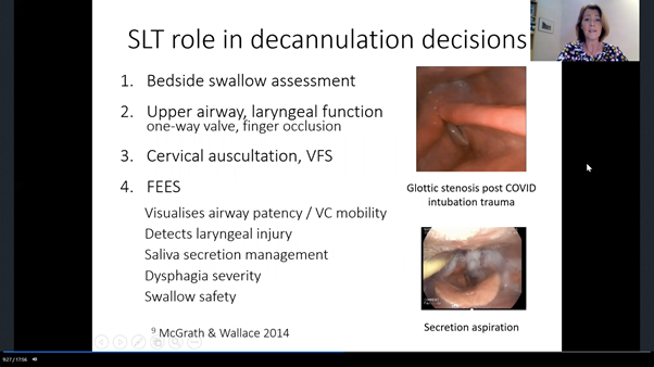 3/  @sarahwallaceslt discussing safe + effective tracheostomy decannulation. Stressing importance of SLT input in the decannulation process as an integrated member of the MDT + presenting the amazing outcomes from the Improving Tracheostomy Care project. #ESSD2020 @_ESSD_