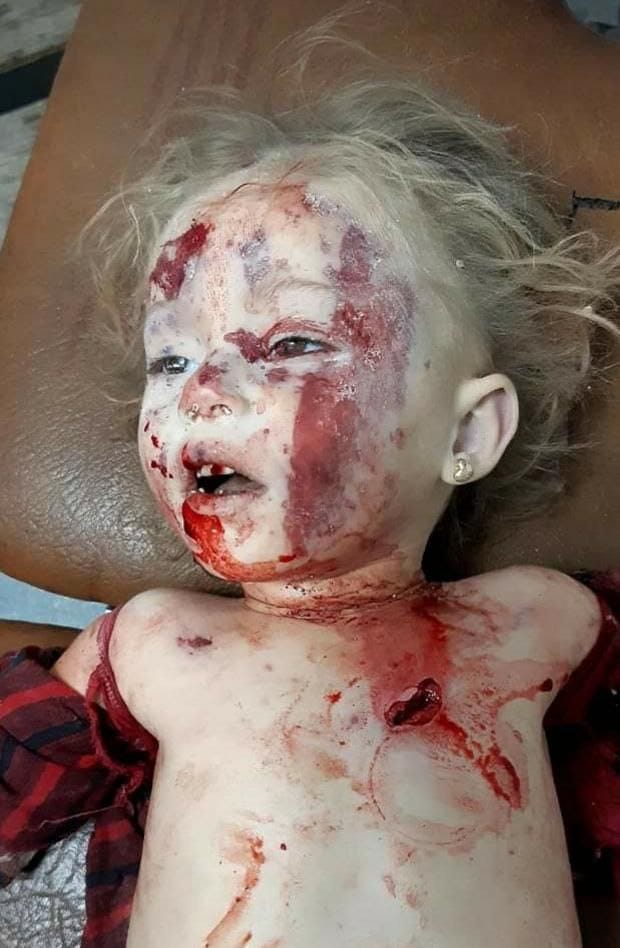 media_idlib's tweet photo. استشهاد الطفلة نجمة سليمان
جراء قصف مدفعي من قبل عصابات بشار أسد استهدف قرية شنان بجبل الزاوية جنوب ادلب. https://t.co/KV4FshBRJS