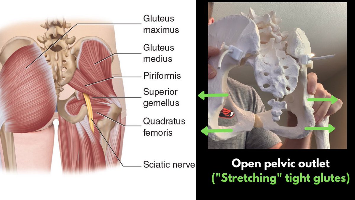 while the pelvic outlet (bottom) spreads apart.Notice where the posterior hip musculature (glutes & that all-so- known piriformis) attach.When we hinge, we are essentially “spreading apart” that musculature while the pelvis goes into:-Internal Rotation-Adduction-Extension
