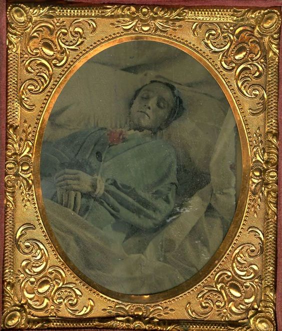 The invention of the daguerreotype in 1839 by Louis-Jacques-Mandé Daguerre gave rise to post-mortem photographs. A common practice would be to pose the deceased in a realistic domestic setting.