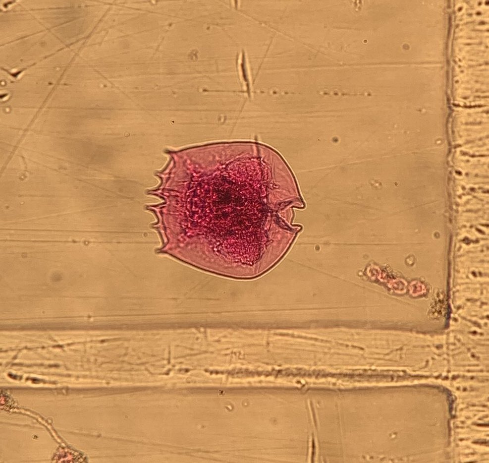 Rotifer or Pac-Man?
