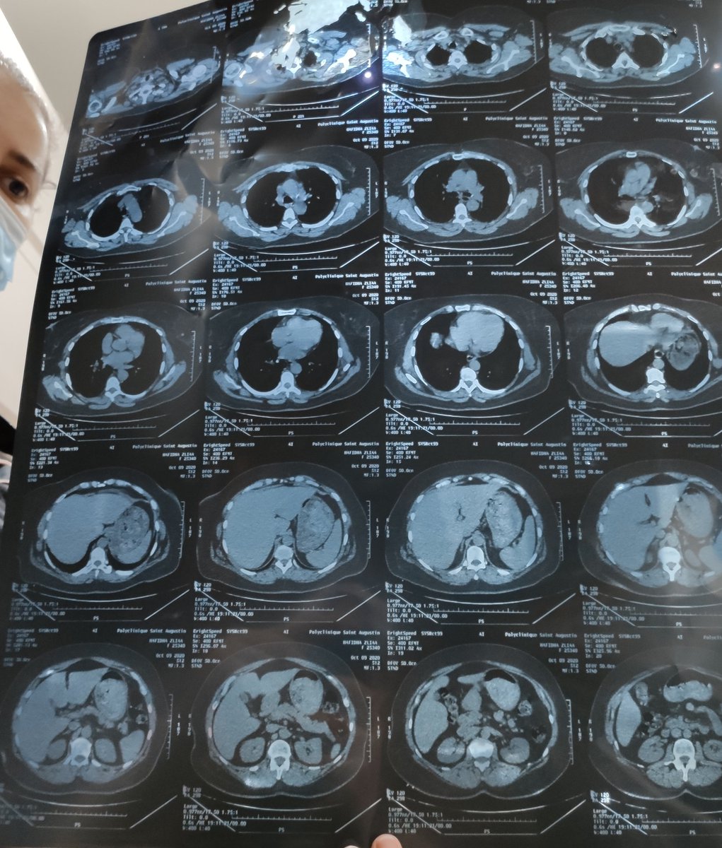 Un avis médical serait le bienvenu.... COVID ? Hospitalisation ? 
#Covid_19 #SOS #URGENT 
Cc <a href="/Vic_Fit05/">Victor F.</a>