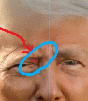 @Sherstar What about the scratch that starts just above the eyebrow and goes under the eye?