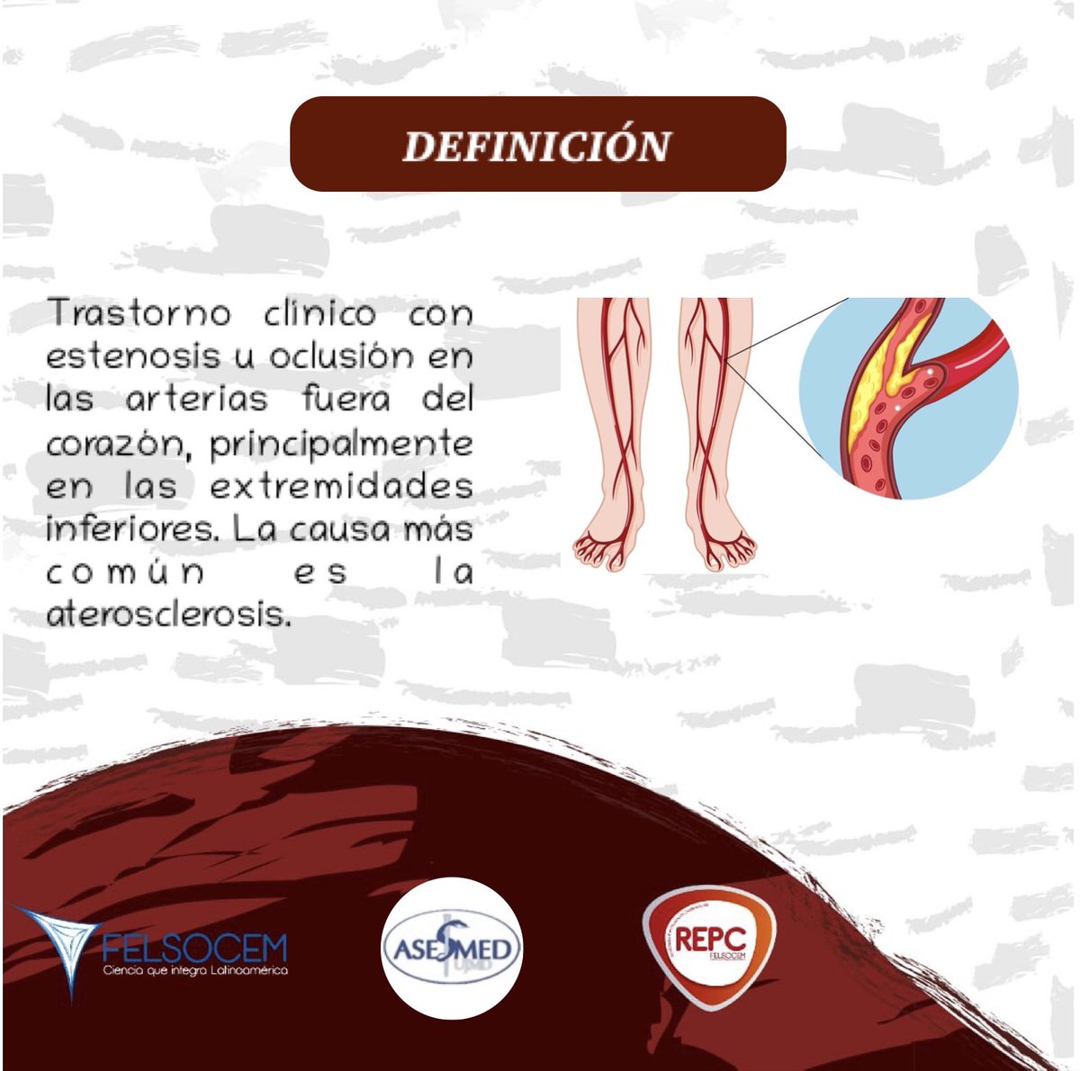 repcfelsocem's tweet photo. ¡Buenas tardes, familia FELSOCEM!🌎💙
Aquí seguimos con nuestros Viernes Académicos al mejor estilo que solo REPC🍓 te puede ofrecer, nada más y nada menos que otra edición de los Red Friday

En esta ocasión presentamos: 

Arteriopatía Periférica

Bibliografía: https://t.co/eQQkdHHEn3