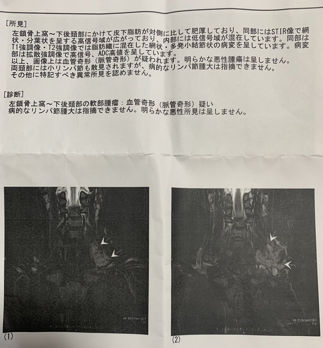 血管奇形 - Twitter Search / Twitter