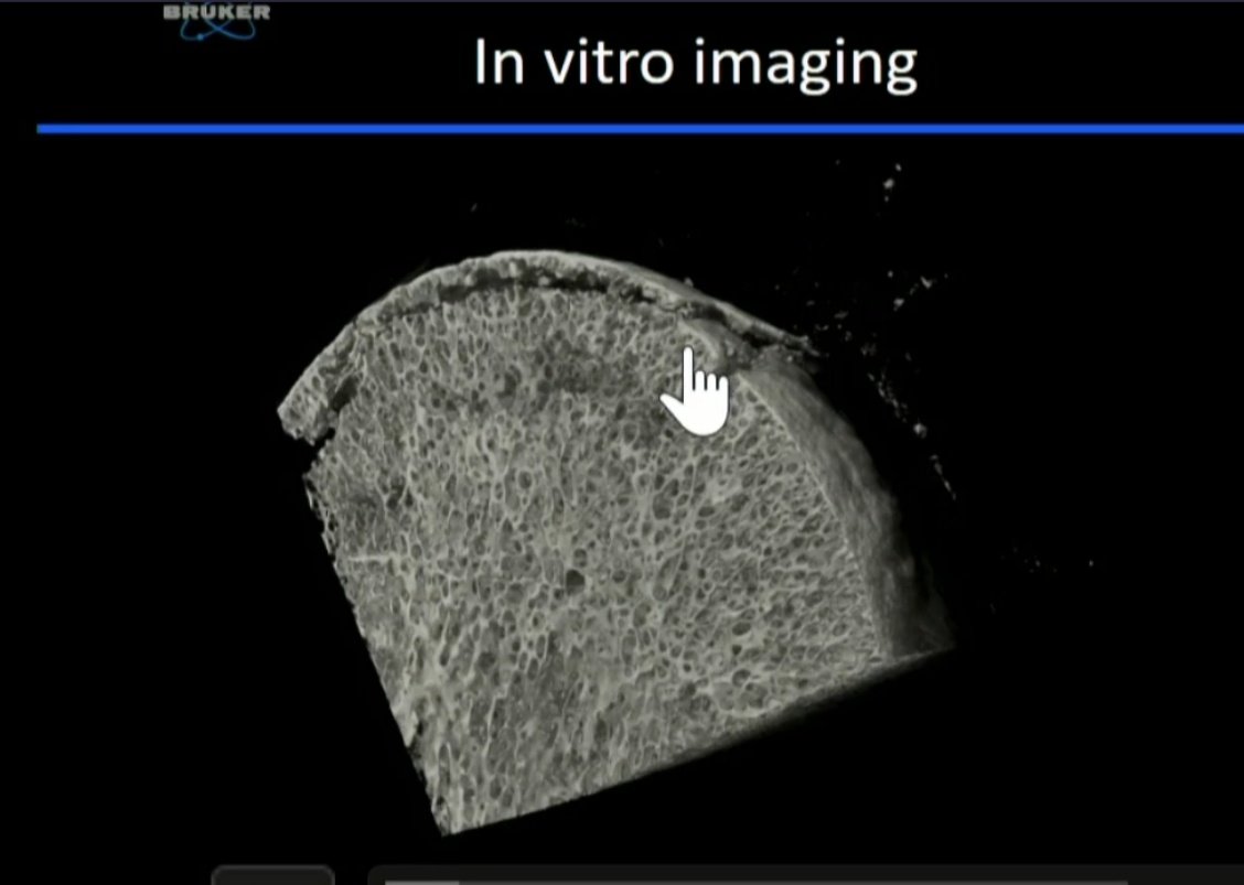 Vilavaite's tweet photo. Amazing presentation about femoral head #osteonecrosis #imaging
Great in vitro microfractures micro #CT images
"#Microfractures in viable areas of ON and OA femoral heads: scattered, do not form clusters"
#ISS2020virtual #MSKRad #ISS2020
@intskeletal
https://t.co/1TACBaSwHJ https://t.co/fJa3JzTmUM