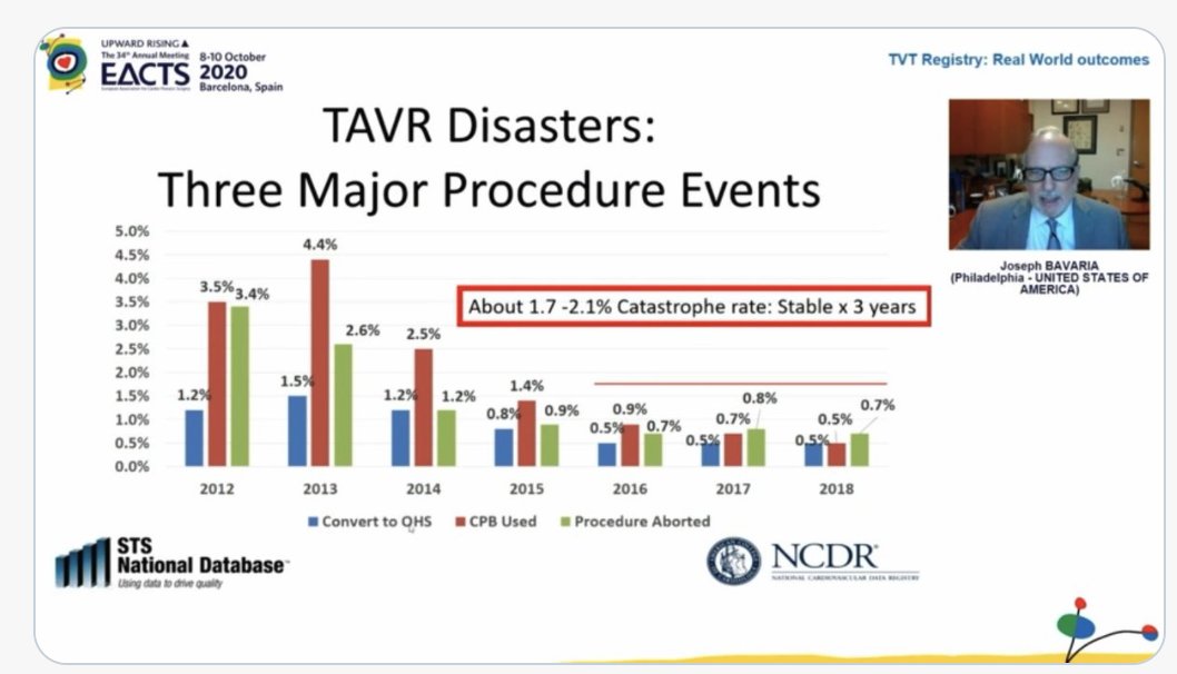 Here is the problem: Dr. Bavaria presentation of TVT registry data of what is actually happening in the real world shows that low-risk patients are increasingly having TAVI. But rates of serious complications, stroke, pacemakers, are not budging much.