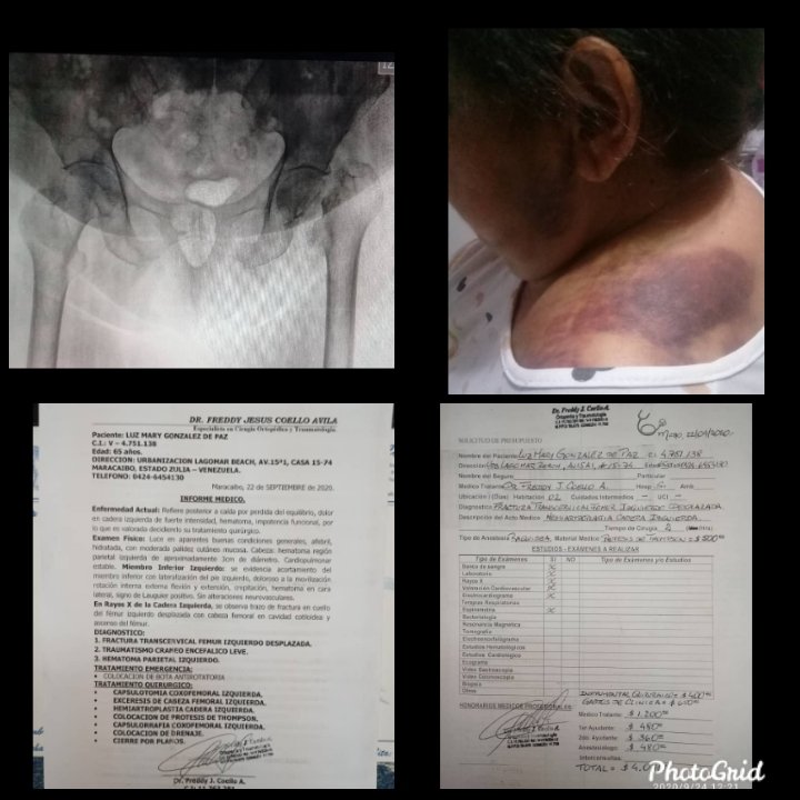 mayralgonz's tweet photo. Buenos días a todas y todos. Necesito de su ayuda , mi hermana se fracturó la cadera y necesita una operación de prótesis para volver a caminar @dcabellor https://t.co/5Euo8UhXwt