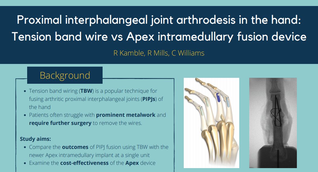 BritOrthopaedic's tweet image. Congratulations to Rituja Kamble! The winner of the best poster award from this year's BOA Virtual Congress with Abstract Number 1649 - Proximal interphalangeal joint arthrodesis in the hand: tension band wire vs Apex intramedullary fusion device #BOA2020 boa.ac.uk/uploads/assets…