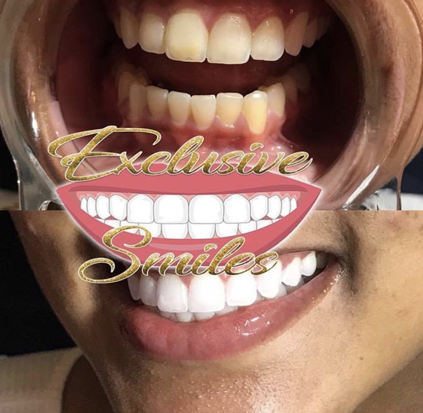 ImRealExclusive's tweet photo. I’m the teeth Goat. It’s clear as day😳 https://t.co/oIw9n7Z5XW