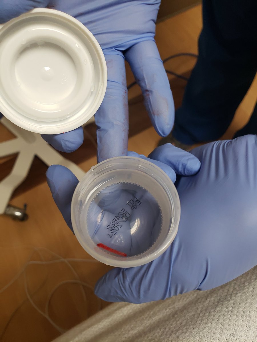 Stephen_Roloff's tweet photo. So that's my bone marrow https://t.co/izvy26DSTI