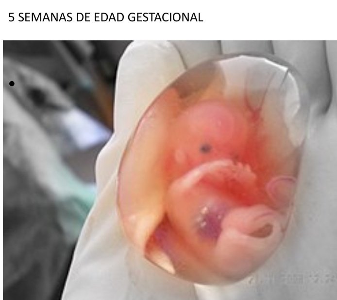 Akamaru_Opresor's tweet photo. @xneilalmightyx @WakonIchi @ClownsCatcher @Solar97675359 @ElisaVeramora1 @ManuelaRamos @Ojo_Publico Ojo que no es un ser humano,  es solo un conjunto de celulas.
Mira que yo soy tremendo conjunto de celulas con 19 años https://t.co/7dqscrL71W