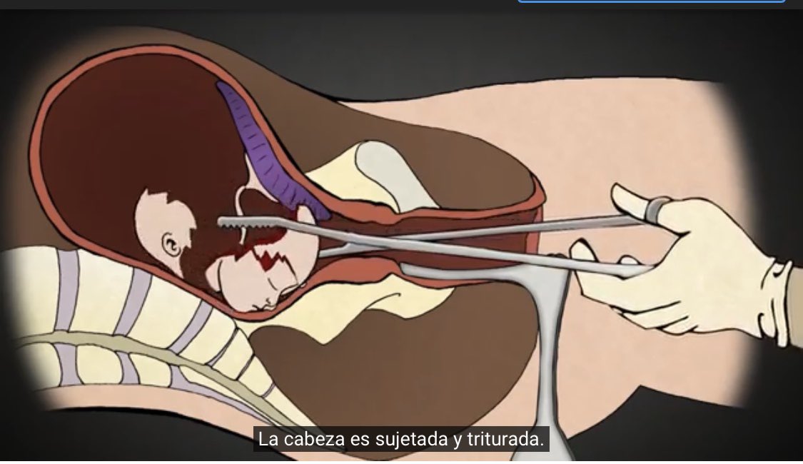 El trapo verde es muerte 👇🏻