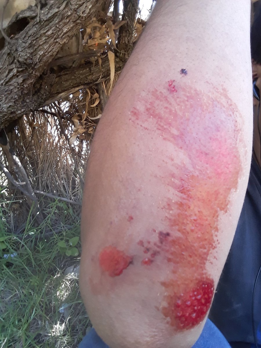 lalothc_420's tweet photo. A seguir dandole esas rampas las tengo que dominar al cien nada me detiene mas que el miedo al fracaso https://t.co/FUU3mRnAFk