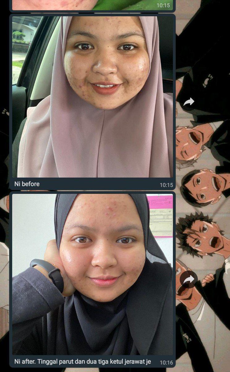 AthenaBeauty1's tweet photo. JUST PAY FOR THE POSTAGE FEE

Mama’s Recipe Skincare 

Bantu kecut dan hilangkan jerawat 
Hilangkan jeragat
Less visible your pores
KKM
SIRIM test ( safe from mercury that harm your skin)

So many good feedback and youalls can purchase it from us authorised agent of MRS https://t.co/xLt7on7ukE