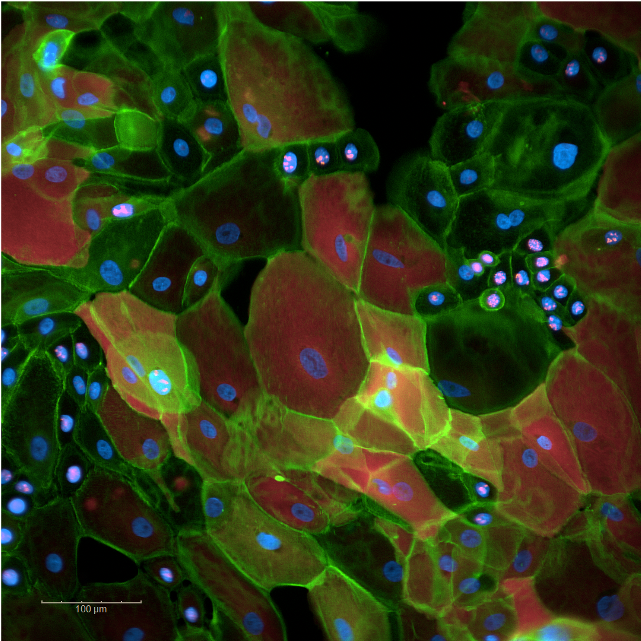 KCLstemcells's tweet photo. These #Skin #cells grown by @landbruce have been depicted by blowing #paint through a straw🥰
Try your hand at #RecreateScience: https://t.co/pE6jR5cC2z
#sciart #kingsculturalcommunity #StemCells @kingsmedicine @CulturalKings @GSTTresearch https://t.co/fiwt7gWiov