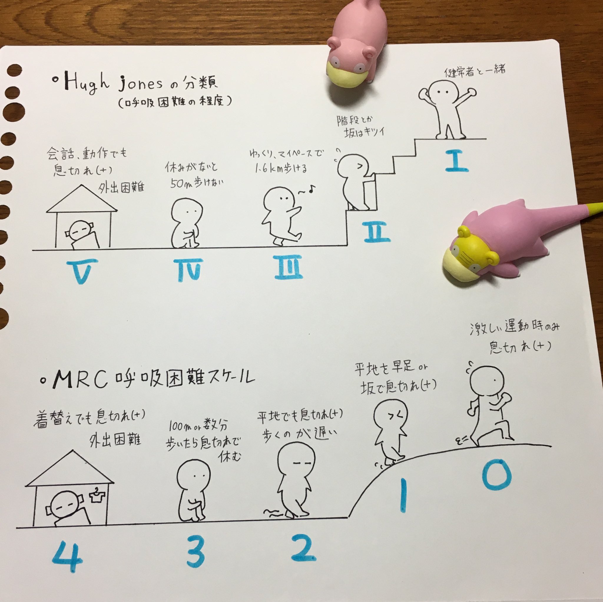 ヤドン On Twitter まとめてみた Hugh Jones ヒュー ジョーンズ の呼吸困難分類 Mrcスケール 息切れ のアセスメントスケール 呼吸 呼吸困難分類 ヤ丼