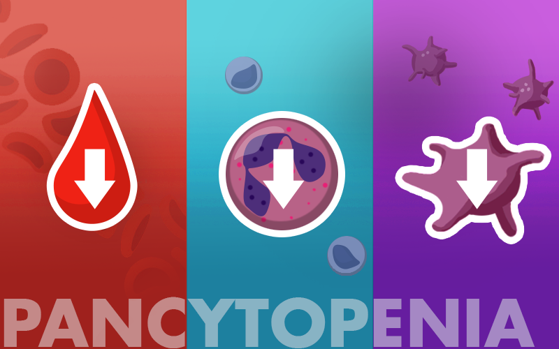 runthelistpod's tweet photo. Because we ♥️ #SpacedRepetition, let’s revisit Pancytopenia with another RTL #Tweetorial!
Thanks @_Nick_Arp for this week’s edition! https://t.co/i1gm9Bs4Be