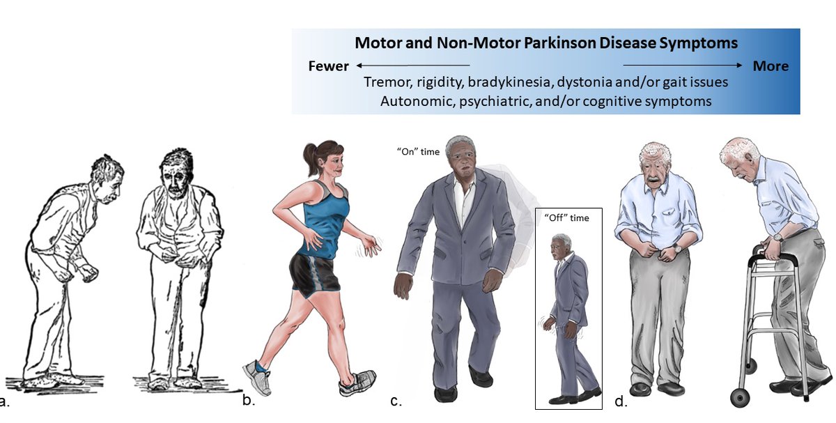 Have you changed your slides to reflect the new image of Parkinson's disease by Armstrong et. al. in JAMA Neurology? Time to retire the Gower's sketch. ow.ly/Cyzm50BDOmC