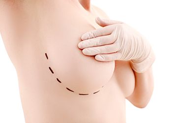 Understanding Insurance Benefits for Breast Reconstruction Accessories