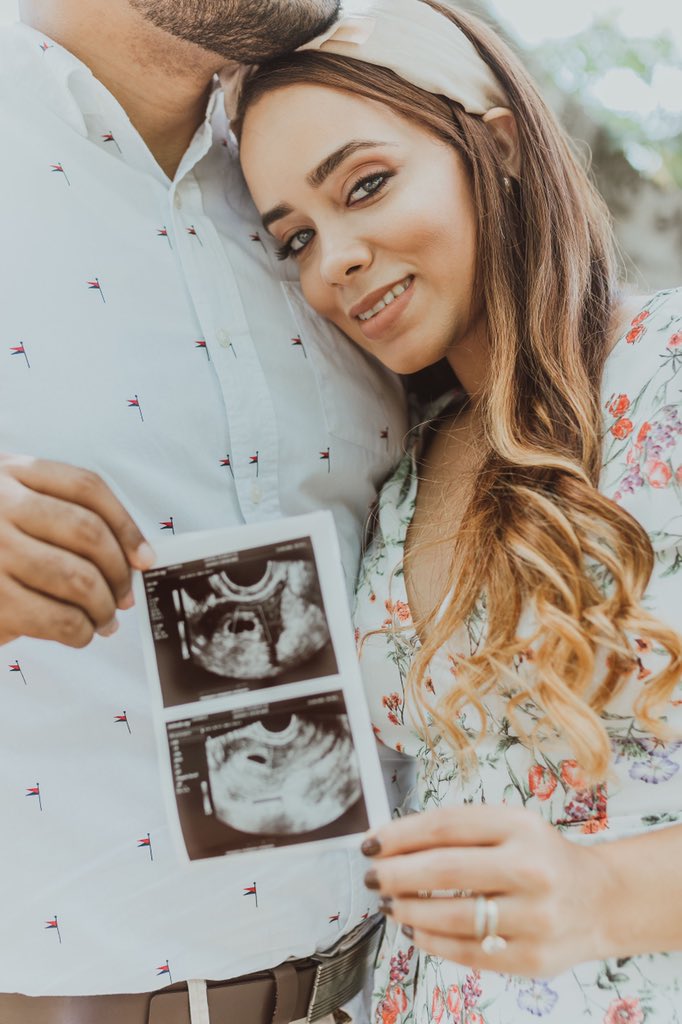 ArletteRiveraB's tweet photo. ¡𝑩𝒂𝒃𝒚 𝒊𝒔 C𝒐𝒎𝒊𝒏𝒈! 🤰🏻♥️
Gracias Dios por el milagro de vida que ha plantado en nosotros, nuestro mayor anhelo. Nos demostraste a través de este proceso que tu tiempo es perfecto y cuando las manos del hombre se cansan, vienen la tuya, la que siempre nos sostienen. https://t.co/5yLtGb843Z