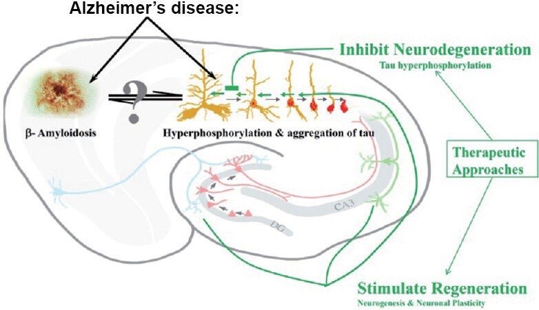 PeptideScience's tweet photo. Peptide P21 slows the progression of neurodegeneration and Alzheimer’s by removing Tau protein build-up and reducing the production of Beta Amyloid plaques.

#Peptides #P21 #P021 #Alzheimers #BetaAmyloid #Tau #NFT #Neurogenesis #BDNF #Synaptic #Plasticity

https://t.co/VxxvqcAu3j https://t.co/cIgcUS0bcd