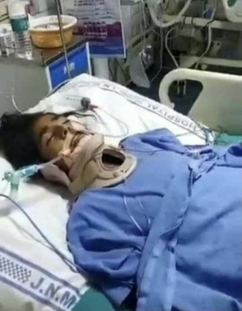 samtreasury's tweet photo. Sadly nothing has changed in India from Nirbhaya to Manisha! 
Tongue cut off, Neck and Spinal cord broken. 
She couldn't survive the brutal rape and passed away. 
#JusticeForManisha 
#JusticeForManishaValmiki #HathrasCase #Hathras https://t.co/ZS11tsudQP