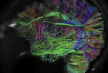 ecalixto's tweet photo. Para hacer más SALUDABLE al cerebro:
Un café, con medida.
Ejercicio.
Perdonar.
Meditación.
Aprender 2 cosas al mes
Abrazar.
Enojarse menos.
Jerarquizar problemas.
Llorar cuando lo necesites, reír cuando sea posible.
#NochedeNeuroTuits https://t.co/UejyTq7EeG