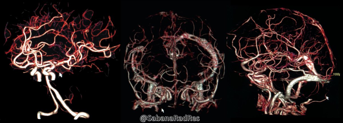 SabanaRadRes's tweet photo. #RadCase 🖥 #Radiology #FOAMrad https://t.co/03W2cxhqmd